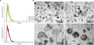 Proteomic characterization of extracellular vesicles released by third stage larvae of the zoonotic parasite Anisakis pegreffii (Nematoda: Anisakidae)